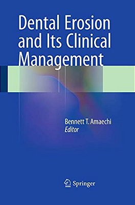 Dental Erosion And Its Clinical Management-..