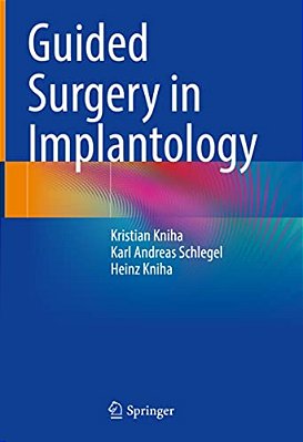 Guided Surgery In Implantology-..