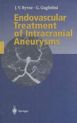 Endovascular Treatment Of Intracranial Aneurysms-..