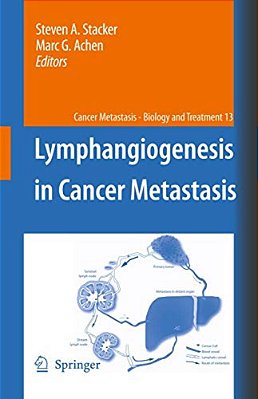 Lymphangiogenesis In Cancer Metastasis-..