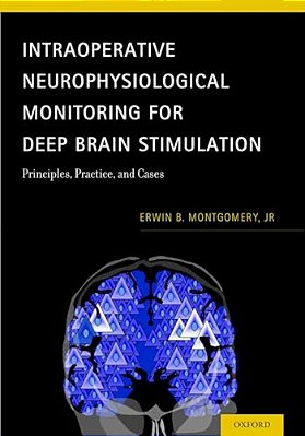 Intraoperative Neurophysiological Monitoring For Deep Brain Stimulation: Principles, Practice, And Cases-..