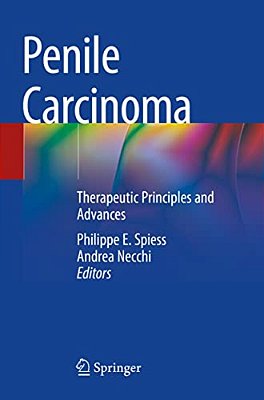 Penile Carcinoma: Therapeutic Principles And Advances-..