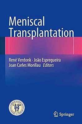 Meniscal Transplantation-..
