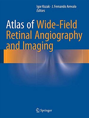Atlas Of Wide-Field Retinal Angiography And Imaging-..