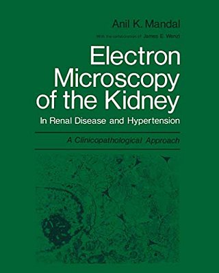 Electron Microscopy Of The Kidney: In Renal Disease And Hypertension: A Clinicopathological Approach-..