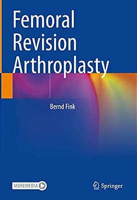 Femoral Revision Arthroplasty-..