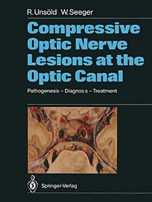 Compressive Optic Nerve Lesions At The Optic Canal: Pathogenesis - Diagnosis - Treatment-..