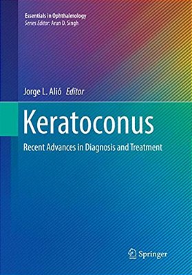 Keratoconus: Recent Advances In Diagnosis And Treatment-..