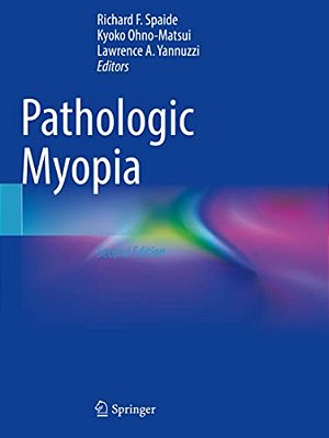 Pathologic Myopia-..