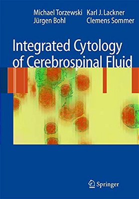 Integrated Cytology Of Cerebrospinal Fluid-..