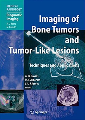 Imaging Of Bone Tumors And Tumor-Like Lesions: Techniques And Applications-..