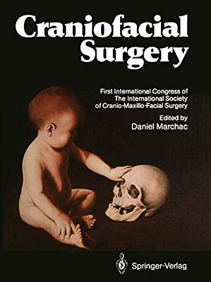 Craniofacial Surgery: Proceedings Of The First International Congress Of The International Society Of Cranio-Maxillo-facial Surgery. President: Paul T-..