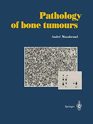Pathology Of Bone Tumours: Personal Experience-..