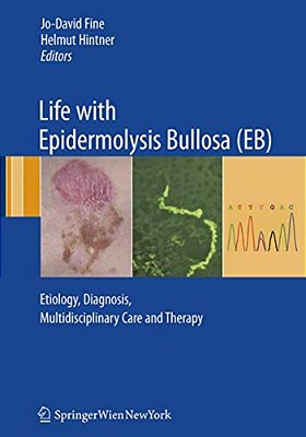 Life With Epidermolysis Bullosa (Eb): Etiology, Diagnosis, Multidisciplinary Care And Therapy-..