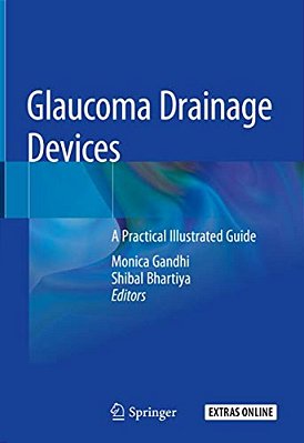 Glaucoma Drainage Devices: A Practical Illustrated Guide-..