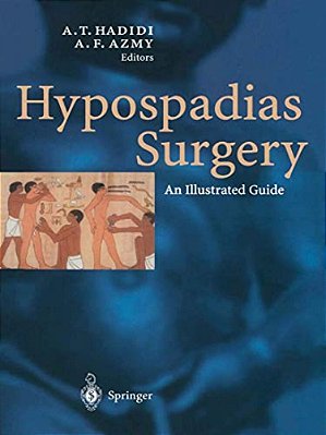 Hypospadias Surgery: An Illustrated Guide-..