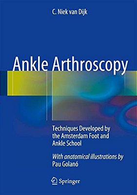 Ankle Arthroscopy: Techniques Developed By The Amsterdam Foot And Ankle School-..