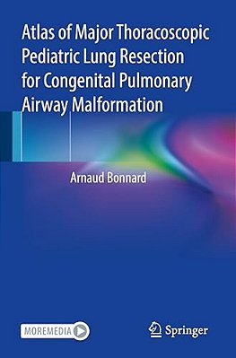 Atlas Of Major Thoracoscopic Pediatric Lung Resection For Congenital Pulmonary Airway Malformation-..