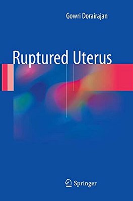 Ruptured Uterus-..