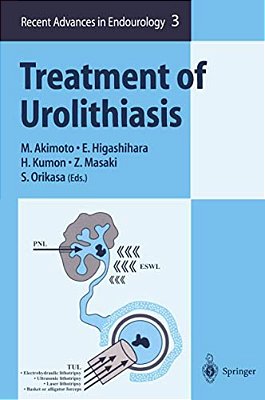 Treatment Of Urolithiasis-..