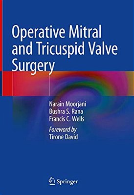 Operative Mitral And Tricuspid Valve Surgery-..