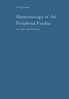 Biomicroscopy Of The Peripheral Fundus: An Atlas And Textbook-..