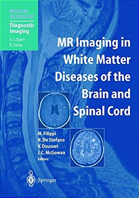 Mr Imaging In White Matter Diseases Of The Brain And Spinal Cord-..