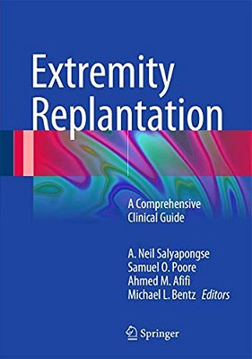 Extremity Replantation: A Comprehensive Clinical Guide-..