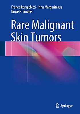 Rare Malignant Skin Tumors-..