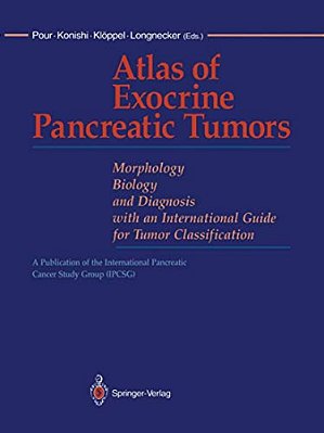 Atlas Of Exocrine Pancreatic Tumors: Morphology, Biology, And Diagnosis With An International Guide For Tumor Classification-..