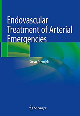 Endovascular Treatment Of Arterial Emergencies-..