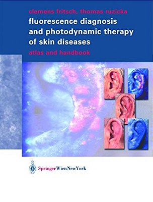 Fluorescence Diagnosis And Photodynamic Therapy Of Skin Diseases: Atlas And Handbook-..