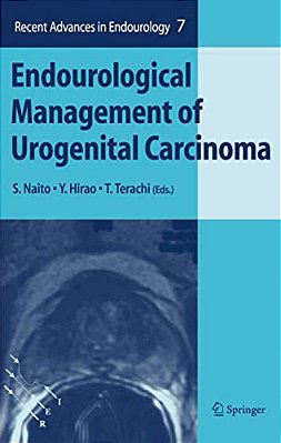 Endourological Management Of Urogenital Carcinoma-..