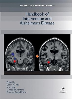 Handbook Of Intervention And Alzheimer's Disease-..
