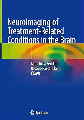 Neuroimaging Of Treatment-Related Conditions In The Brain-..