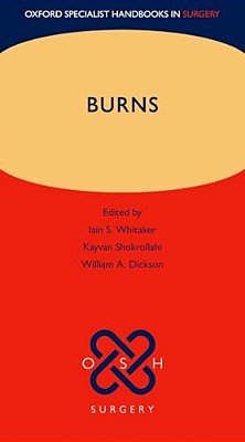 Burns-..