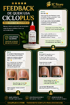 CICLOPLUS – Solução Antimicótica | 15ml