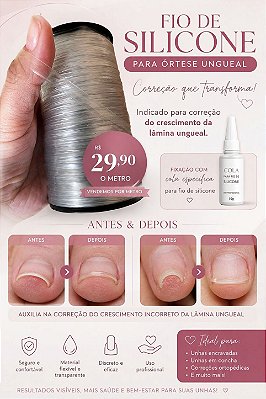 FIO DE SILICONE PARA ÓRTESE UNGUEAL