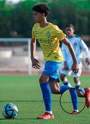 CANELEIRAS PERSONALIZAVEL