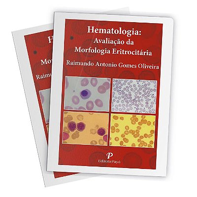 Hematologia: Avaliação da Morfologia Eritrocitária (Pranchas)