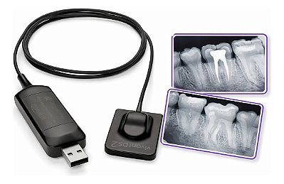 Sensor Digital Vivant Intraoral DS2 - Schuster