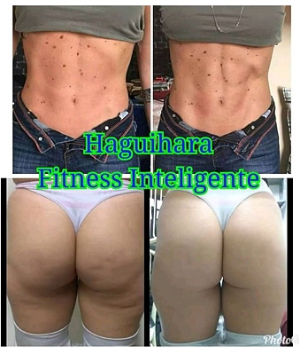 seguimentos