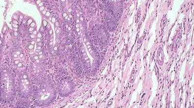 Lâminas Preparadas - Histologia - TIL-H-80