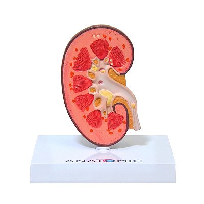 Rim com Patologia - TZJ-0327-P