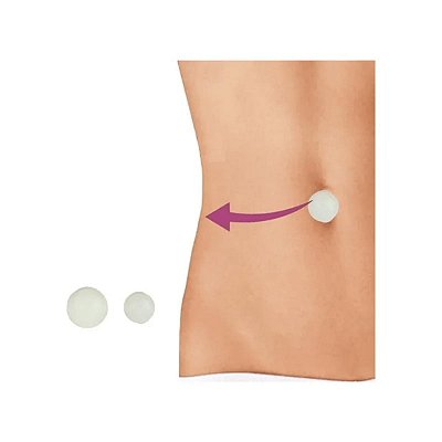 Órtese Siligel Macia Umbigo Esférica 9mm e 12mm Ortho Pauher