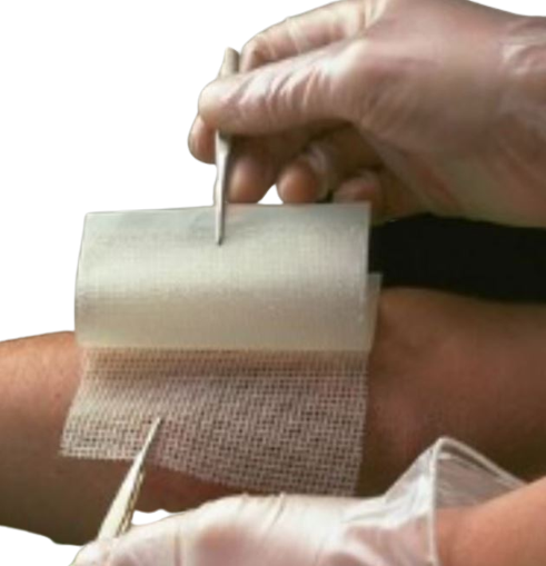 Curativo Bactigras 10x10cm Tela Parafinada com Acetato de Clorexidina Un - Smith & Nephew