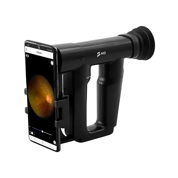 Oftalmoscópio Digital Indireto Portátil EyeScope - MD