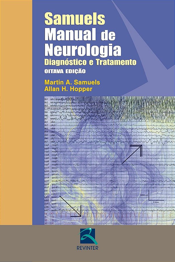 Manual de Neurologia - Diagnóstico e Tratamento - Martin A. Samuels; Allan H. Hopper
