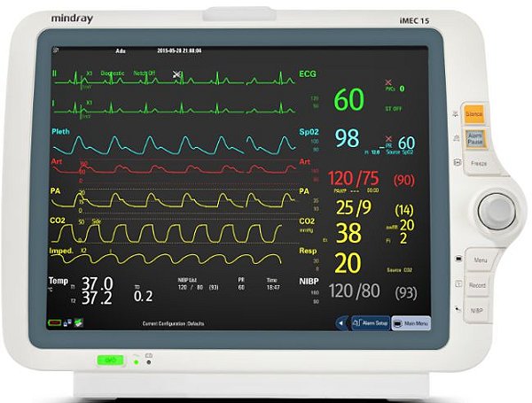 Locação Monitor Multiparametrico Mindray Umec 12