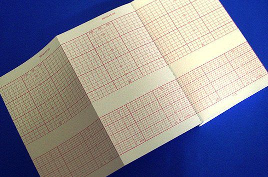 PAPEL TERMOSSENSÍVEL P- ECG TITS 114X70X200FLS